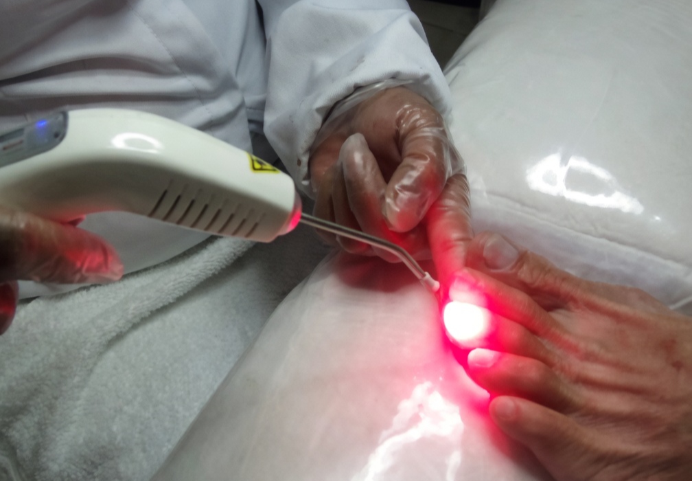 Sessão de laserterapia podológica